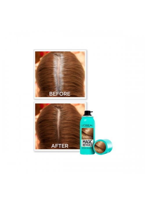 LOREAL MAGIC RETOUCH ΞΑΝΘΟ ΣΚΟΥΡΟ 75ML