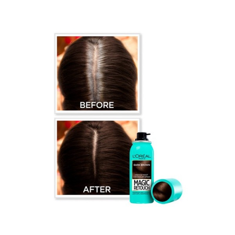 LOREAL MAGIC RETOUCH ΚΑΣΤΑΝΟ ΣΚΟΥΡΟ 75ML